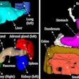 2025 04 22 Radiology Mrisegmenter Thumbnail