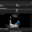 Clarius Prostate AI measures prostate volume from ultrasound exams.