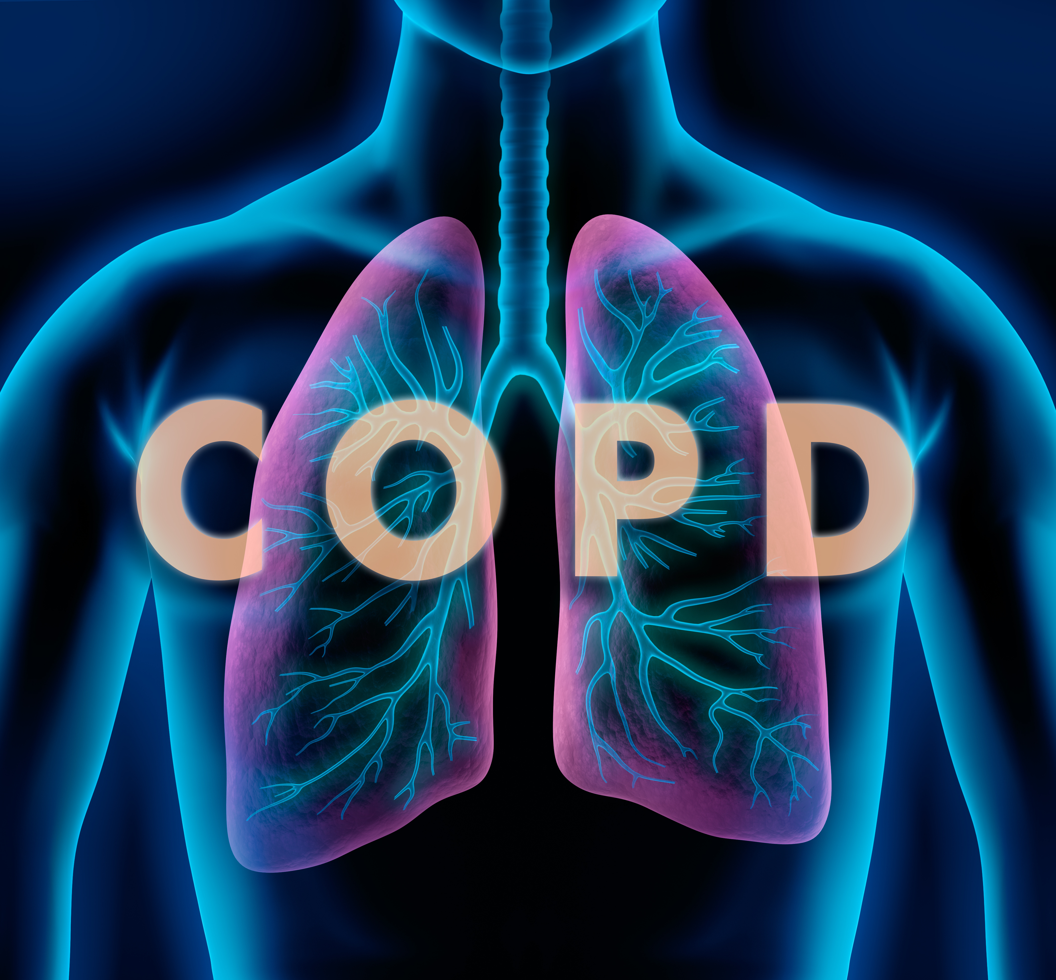 Copd