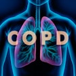 Copd