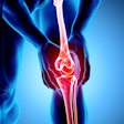Knee Pain Xray 400