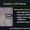 Amie Lee, MD, presented at ARRS 2025 on managing 'controversial' high-risk breast lesions diagnosed on core needle biopsy. This slide outlines how to manage pleomorphic lobular carcinoma in situ (LCIS) via surgical excision.