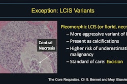 Amie Lee, MD, presented at ARRS 2025 on managing 'controversial' high-risk breast lesions diagnosed on core needle biopsy. This slide outlines how to manage pleomorphic lobular carcinoma in situ (LCIS) via surgical excision.