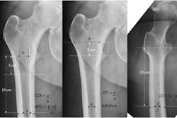 2022 06 22 Hip X Rays