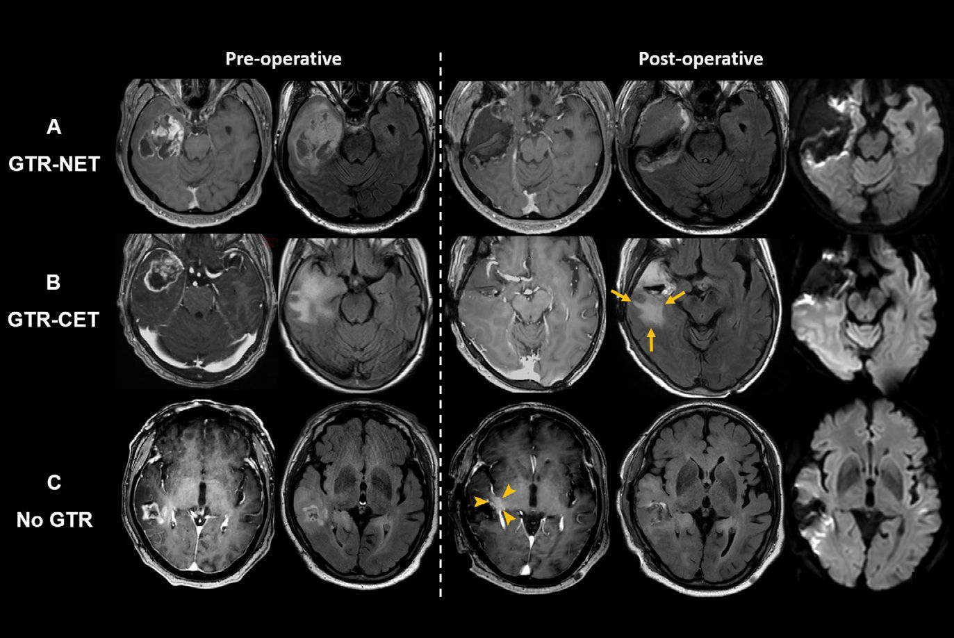 2025 05 06 Radiology Moon Figure1 Thumbnail