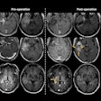 2025 05 06 Radiology Moon Figure1 Thumbnail