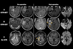 2025 05 06 Radiology Moon Figure1 Thumbnail