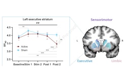 2025 05 09 Brain Stimulation Thumbnail