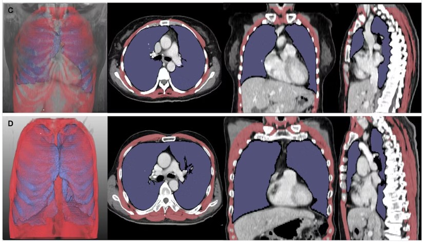 2025 05 14 Images Large Radiol 243463 fig4