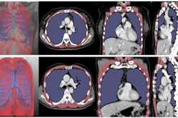 2025 05 14 Images Large Radiol 243463 fig4