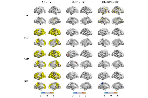 2025 05 14 White Matter Thumbnail
