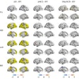 2025 05 14 White Matter Thumbnail