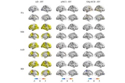 2025 05 14 White Matter Thumbnail
