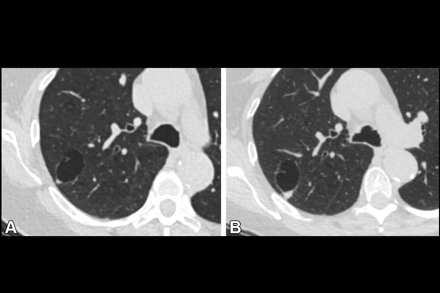 2025 05 20 Radiology Byrne Figure2 Thumbnail