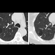 2025 05 20 Radiology Byrne Figure2 Thumbnail