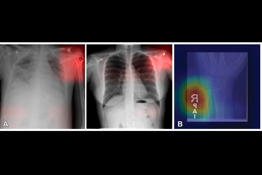 2025 05 20 Yi Et Al Figure3 Thumbnail