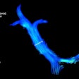 Velocity streamlines of the portal vein measured using 4D flow MRI in a cirrhosis patient (a 62-year-old male), shown at the cardiac cycle time t = 84 ms. A cut-plane (white marker) matching the 2D flow image plane was used to quantify the 4D flow parameters in the main portal vein.