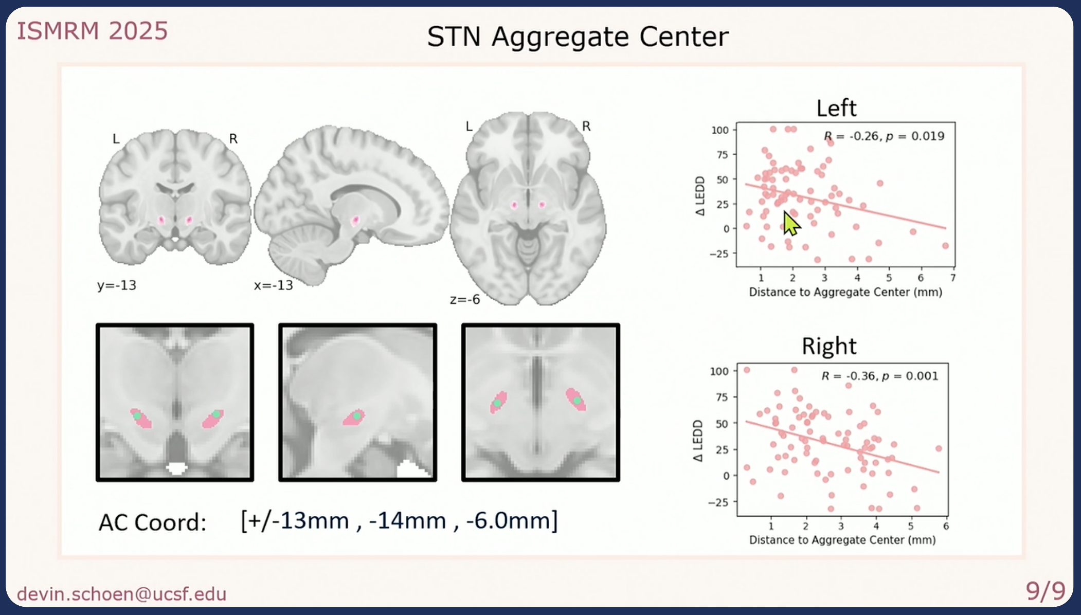 Aggregate Center Stn Schoen Ismrm2025