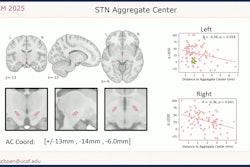 Aggregate Center Stn Schoen Ismrm2025