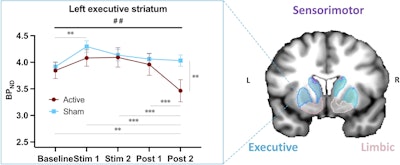 Changes in C-11 raclopride non-displaceable binding potential (BPND) in the left executive striatum during and after frontotemporal tDCS in the active and sham groups. The curves show the variation in BPND across five time points: Baseline (25-40 min), Stim1 (40-55 min), Stim2 (55-70 min), Post1 (70-85 min) and Post2 (85-100 min) for the active group (red line) and the sham group (blue line). A significant decrease in BPND, indicating dopamine release, is observed at Post2 in the active compared with the sham group. Error bars represent the standard error of the mean. # indicates significant Group by Time interaction; * indicates significant post hoc differences. Executive, limbic, and sensorimotor striatal subregions are illustrated for reference as defined by the Oxford-GSK-Imanova connectivity striatal atlas.