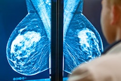 Breast Computer Monitor Mammogram