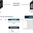 Workflow for FTD, AD, and CN classification using automated brain volumetry. Graphic and caption courtesy of Seung Hyun Lee and the ISMRM.