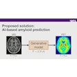 AI models can generate synthetic equivalents to PET images from routinely acquired T1W MRI scans.