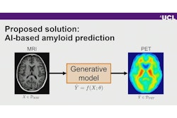 AI models can generate synthetic equivalents to PET images from routinely acquired T1W MRI scans.