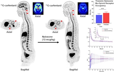 A visual abstract of the study.