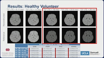 Other Results Healthy Volunteer Highlights Main Li Ismrm2025