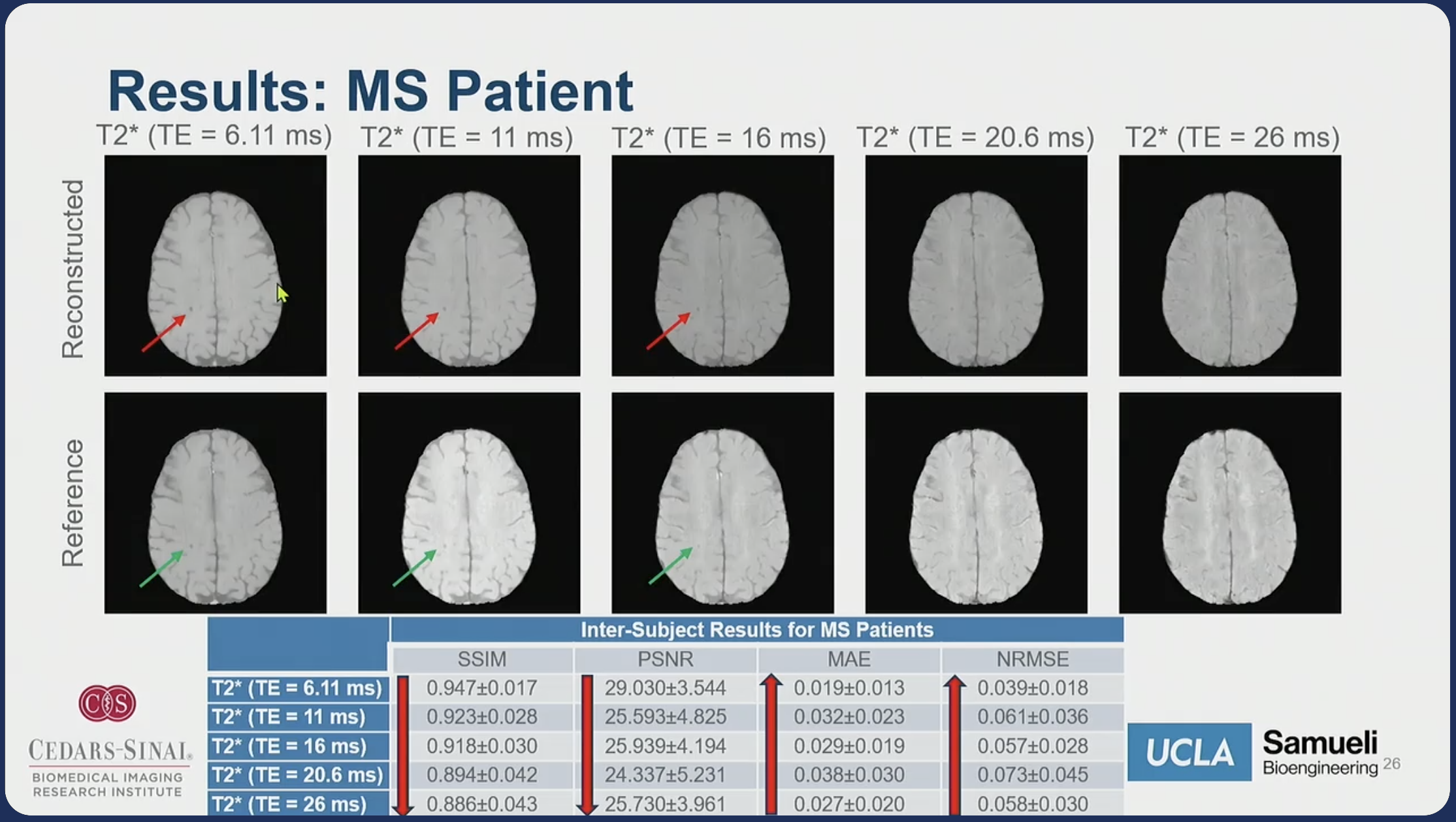 Results Ms Patient Highlight Main Li Ismrm2025