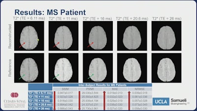 Results Ms Patient Highlight Main Li Ismrm2025