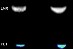 Researchers at ISMRM highlighted the success of a trimodal MR-PET-FUS system built around a low-field MRI scanner. MR (top) and PET (bottom) images were acquired simultaneously before and after FUS heating.