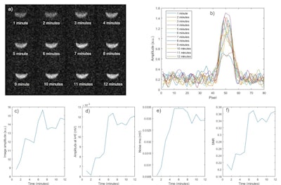 Acquisitions show images during the FUS application. Top: a) average of 75 images acquired every minute, and b) profiles along the central vertical line of the phantom. Bottom: time evolution of c) image amplitude at the center of the phantom, d) measured voltage at center of k-space, e) measured noise, and f) signal-to-noise ratio.