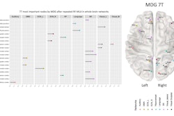 A lollipop plots showing the most important nodes by RF-MLA selected by Mean decrease in Gini for a 7 tesla fMRI dataset, with longer sticks meaning greater importance. Each group of networks’ nodes has its own color matching the same network’s color in the brain map. Nodes' names preceded by a red asterisk are repeated among different networks, matching the red nodes in the brain map, which appear in multiple networks.