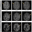 Synth Mri Thumbnail
