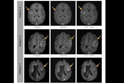Synth Mri Thumbnail