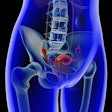 Uterus Pelvic