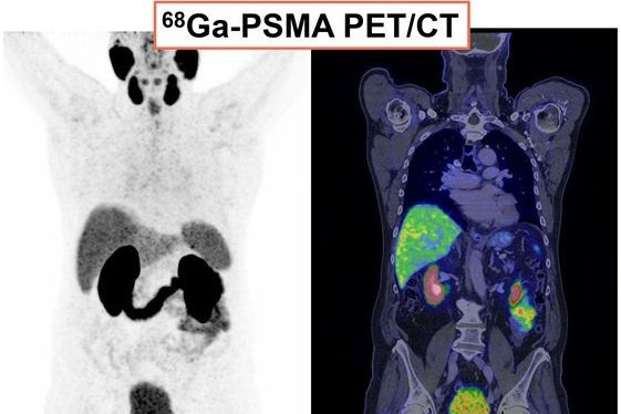 2025 06 12 Visual Abstract Thumbnail