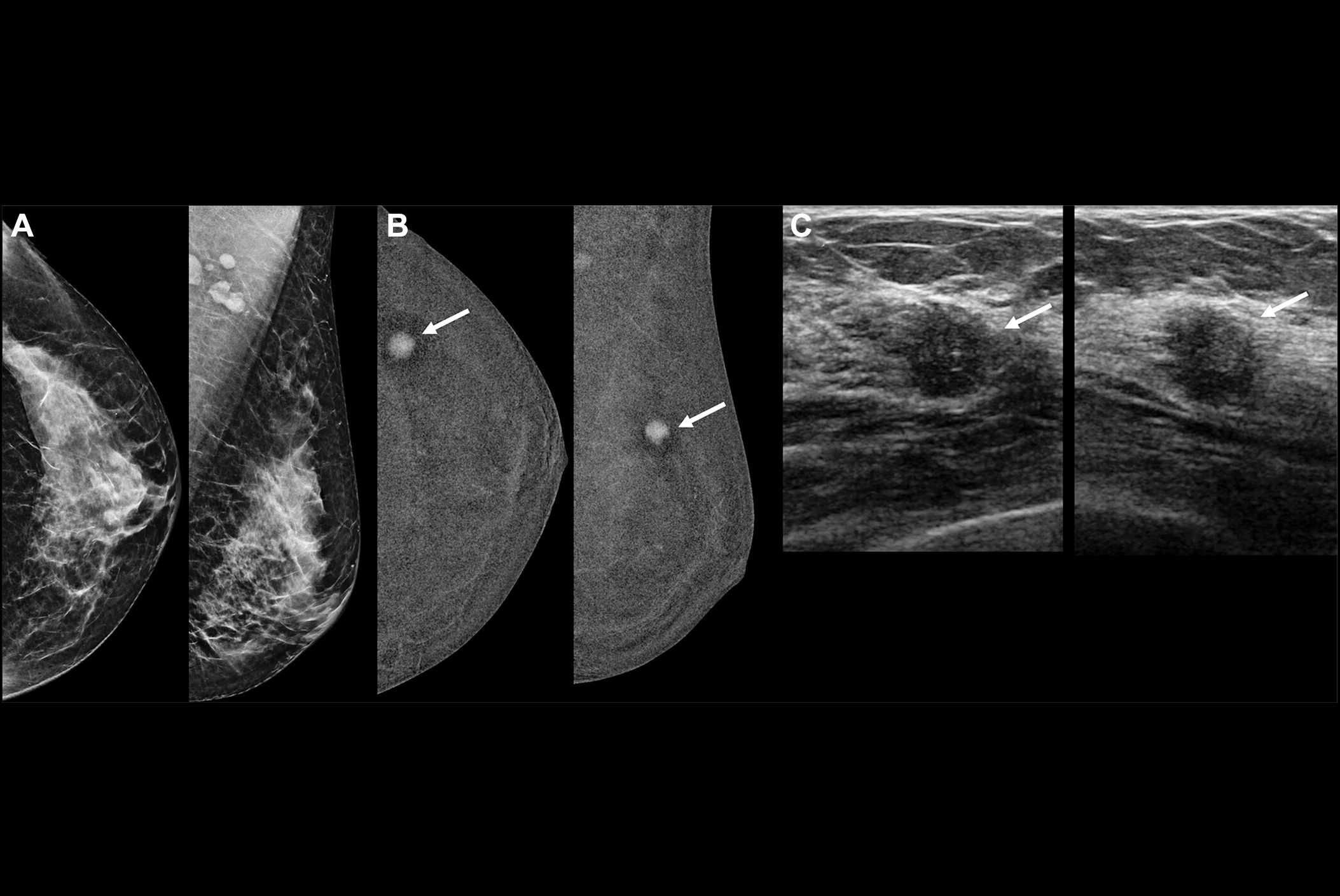 2025 06 17 Radiology Cem Berg Thumbnail