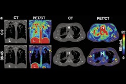 2025 06 24 New Pet Imaging Technique Thumbnail