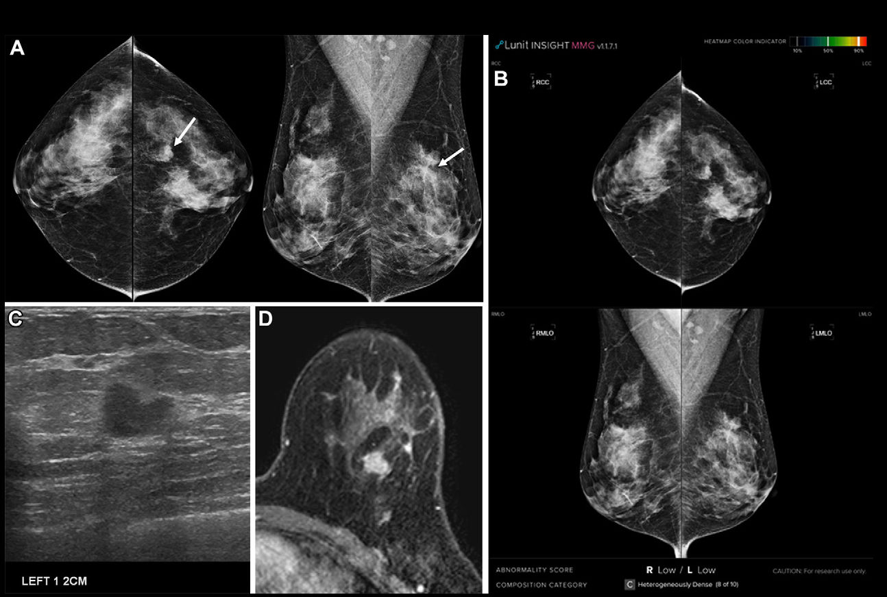 2025 06 24 Radiology Woo Image Thumbnail