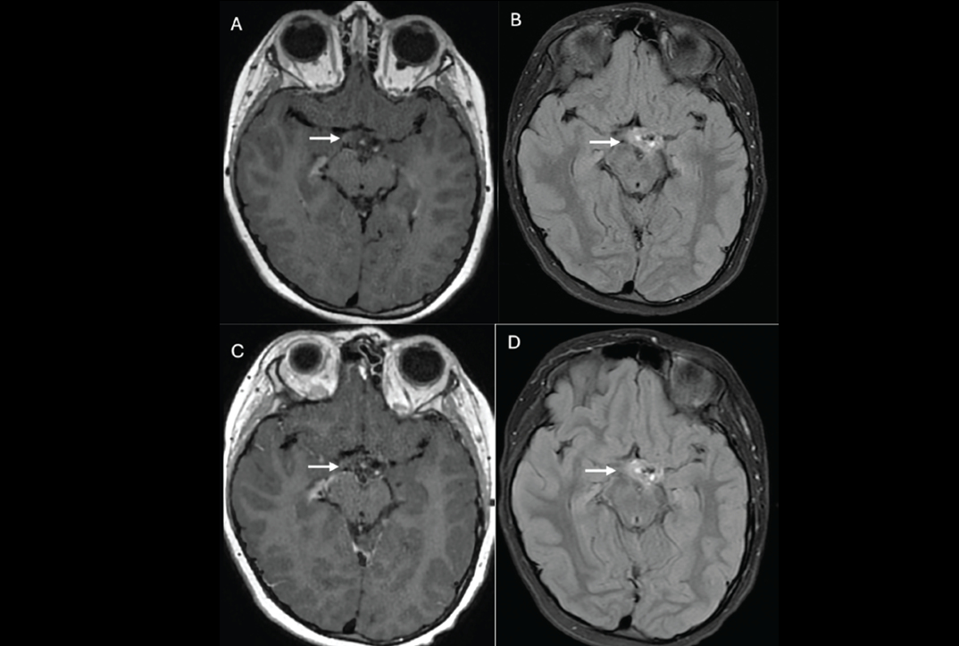 2025 06 25 Ajr Figure Thumbnail