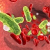 Bacteria Blood Sepsis
