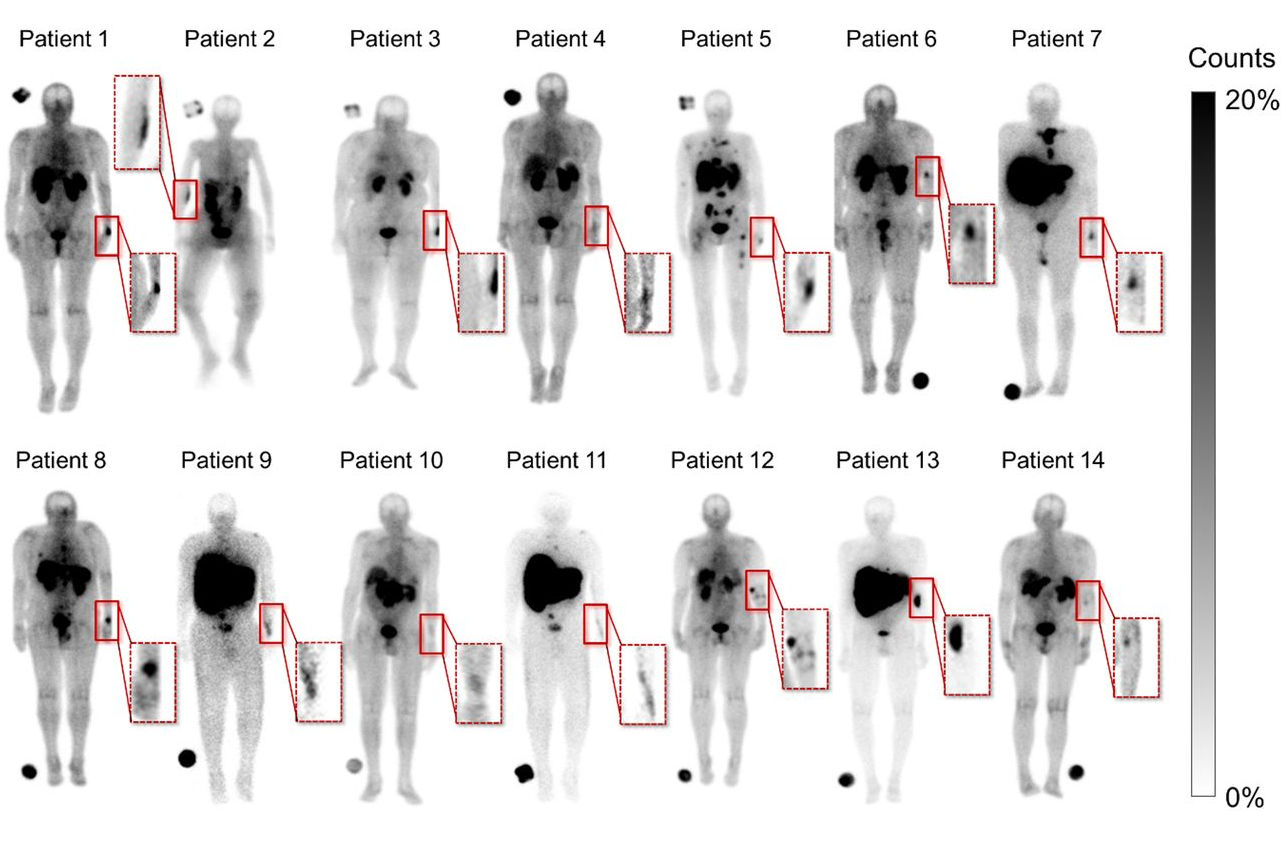 F2large 7 d Wx0 Jy U He U Thumbnail
