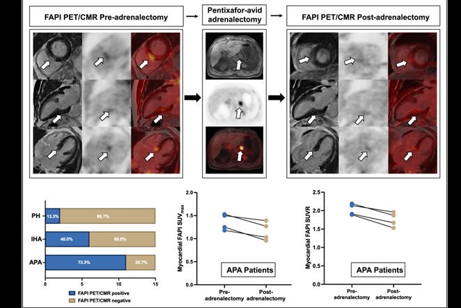 Pa eymt6 J Xb Ss Thumbnail