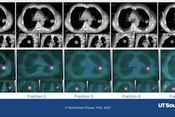 Tumor changes observed at each fraction in the adaptive system.