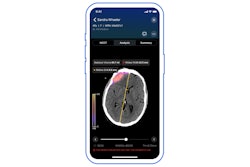 Viz Ai Image Thumbnail
