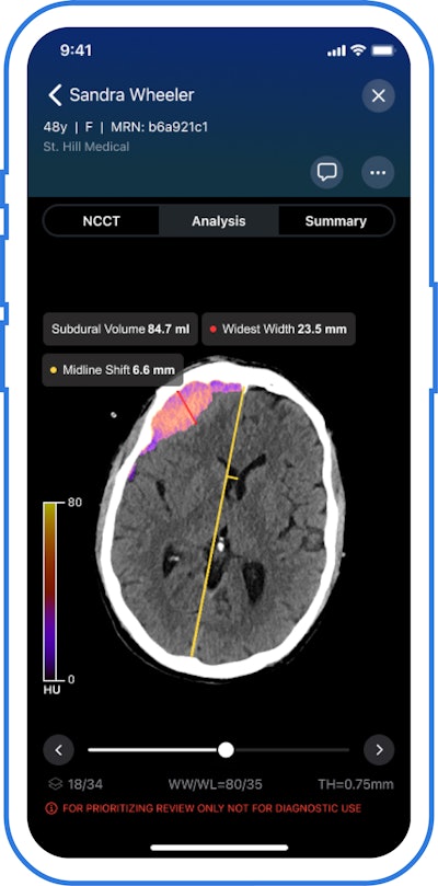 Viz Subdural Plus software.