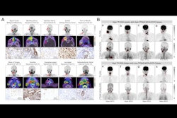 Wang Ioy Image Thumbnail